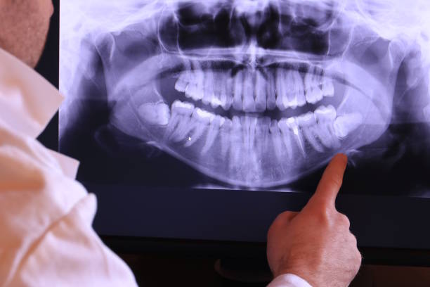 Best Lost Filling or Crown Replacement in Alexandria, IN