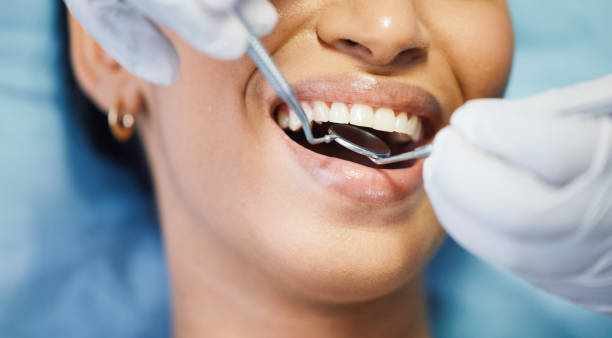 Best Weekend Emergency Dental Services in Alexandria, IN