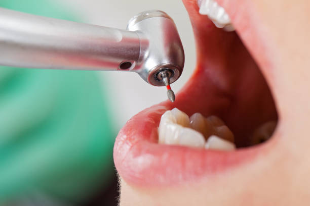 Best Walk-In Emergency Dental Services in Alexandria, IN